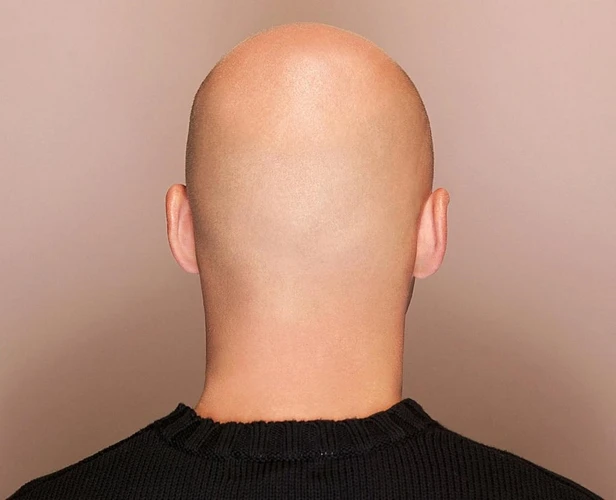 The Significance Of Baldness In Male Dreamers